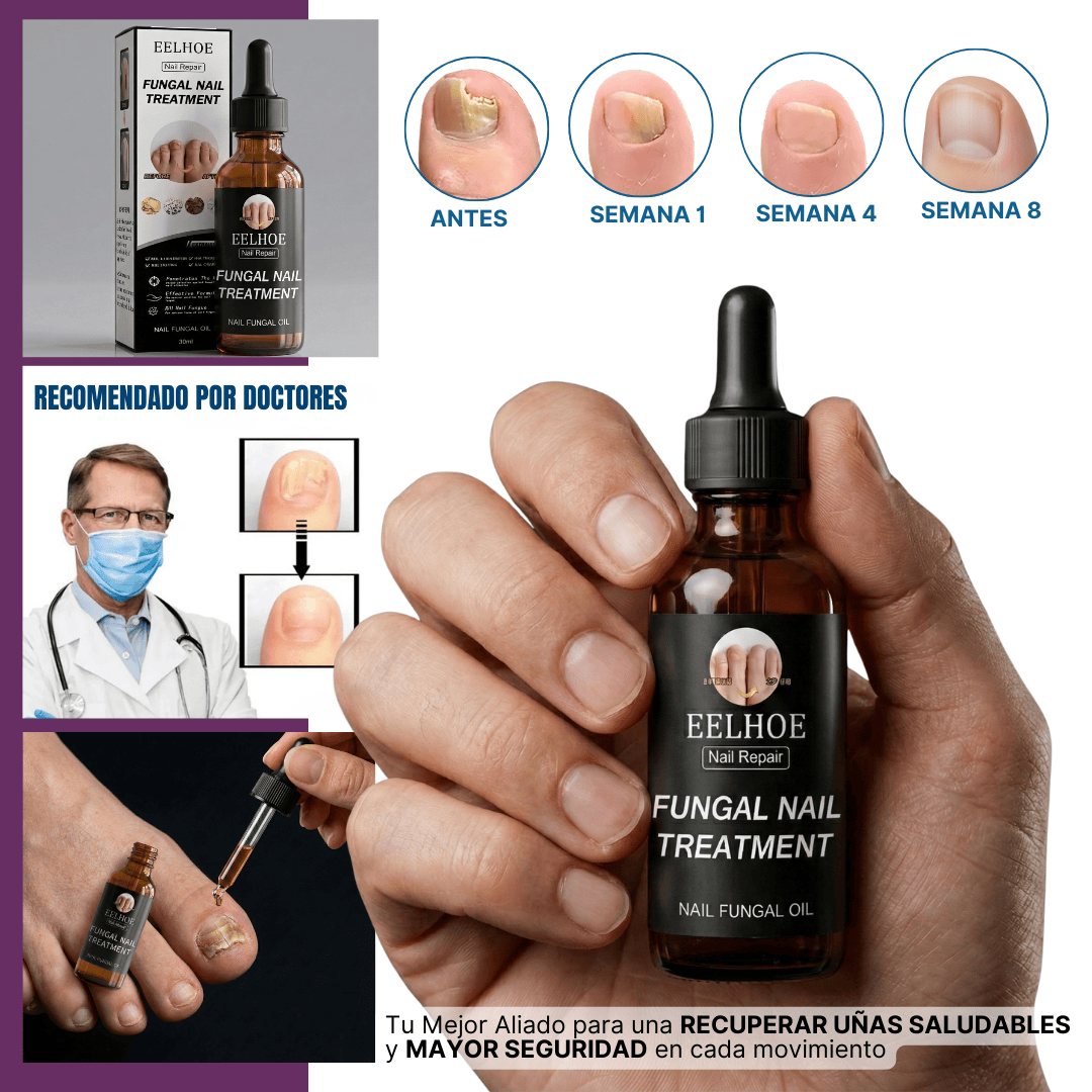 Tratamiento reparador de uñas | Protege y elimina el hongo de tus Uñas