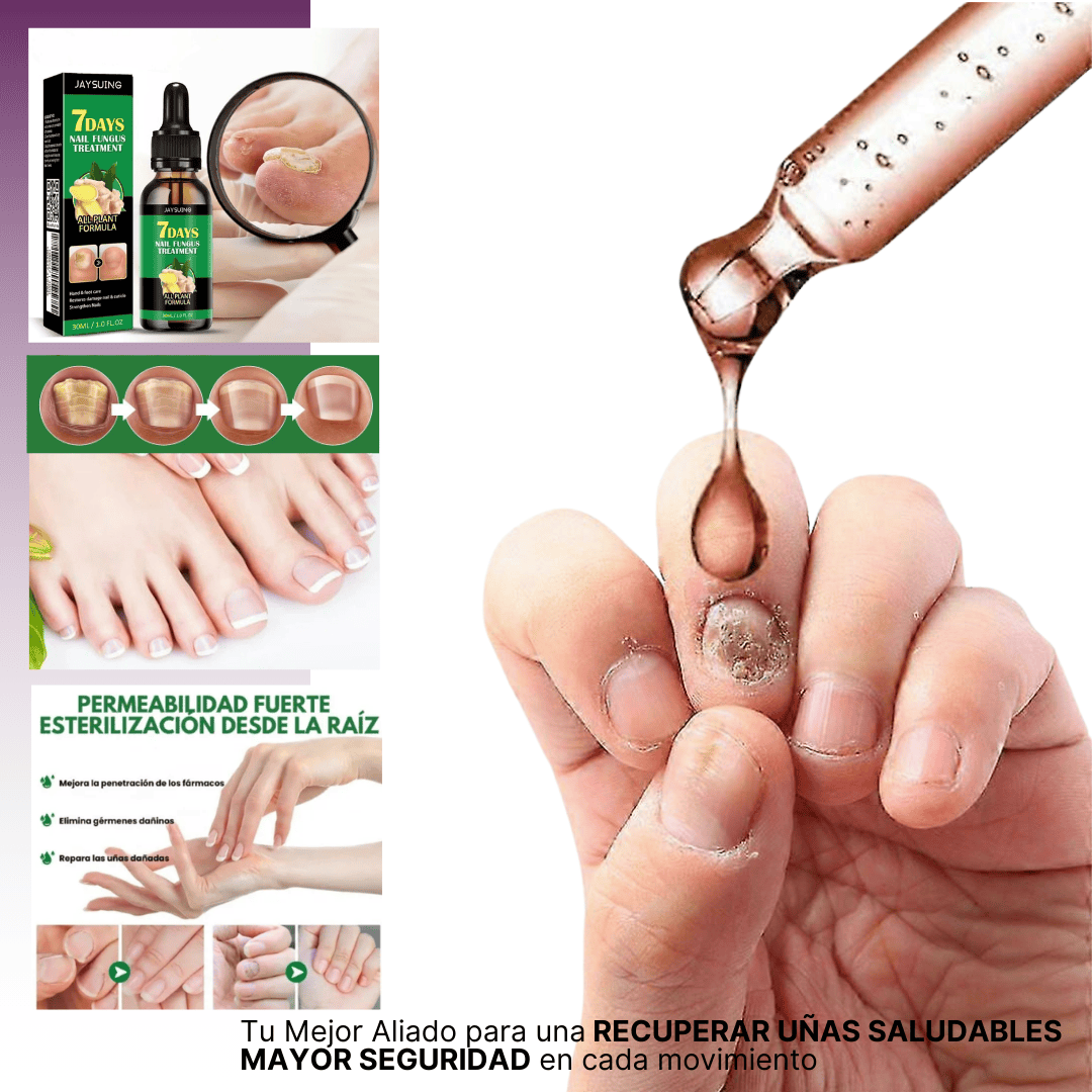 7 Days Fungus Free Nails® | Protege y elimina el hongo de tus Uñas