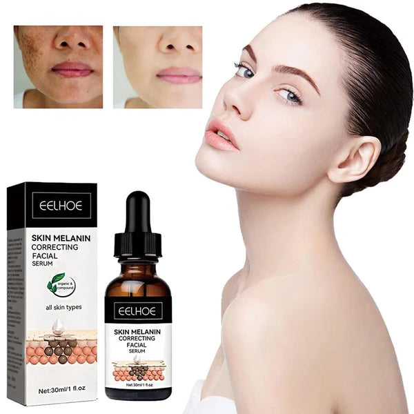 Suero Facial Corrector de Melanina