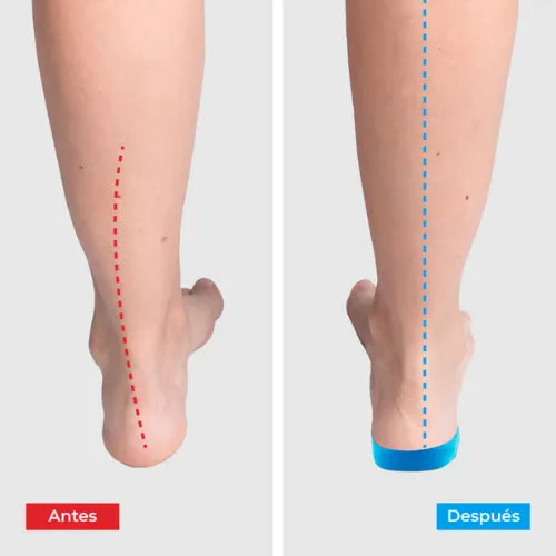 Plantillas ComfyFeet™ | Disfruta de días sin dolor