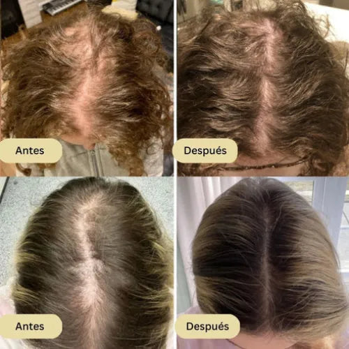 Aceite Natural Veganic Para El Crecimiento Del Cabello.