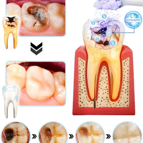Polvo Teeth Restoration | La solución integral para una sonrisa más saludable ¡Compra 1 y lleva 2!