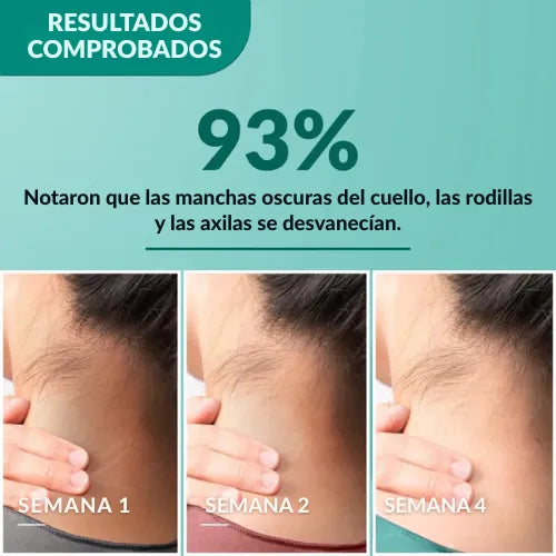 Crema terapéutica para la hiperpigmentación