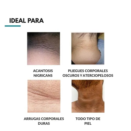 Crema terapéutica para la hiperpigmentación