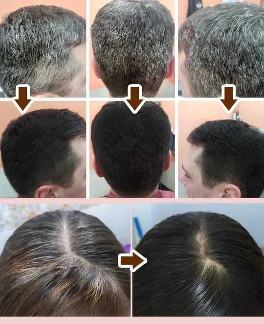 Shampoo Cubrecanas ¡Recupera la salud y color de tu cabello!