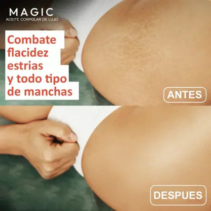 Aceite Corporal Magic™ | Nutre e ilumina tu piel