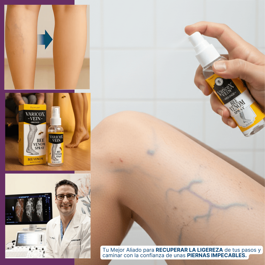 Spray Varicox | ¡Tu aliado en varices y circulación!
