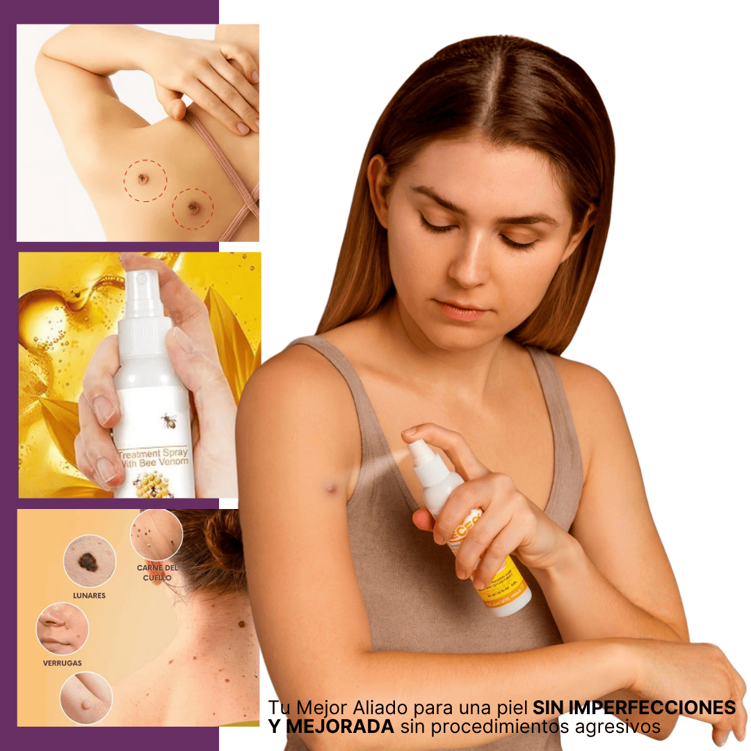Spray Bee Venom Antiverrugas