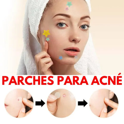 Parches para acné | Despídete del Acné de Forma Rápida y Efectiva