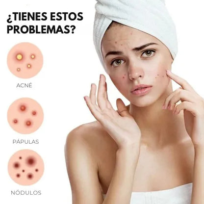 Parches para acné | Despídete del Acné de Forma Rápida y Efectiva