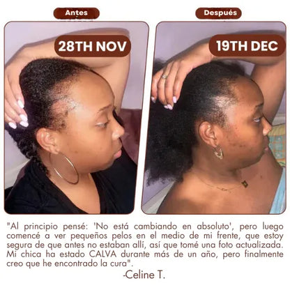 Aceite de Batana para el crecimiento del cabello 100% natural