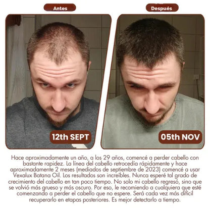 Aceite de Batana para el crecimiento del cabello 100% natural
