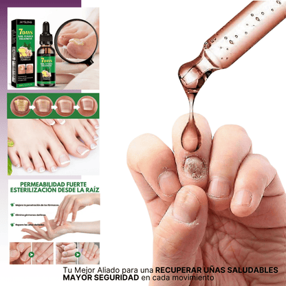 7 Days Fungus Free Nails® | Protege y elimina el hongo de tus Uñas