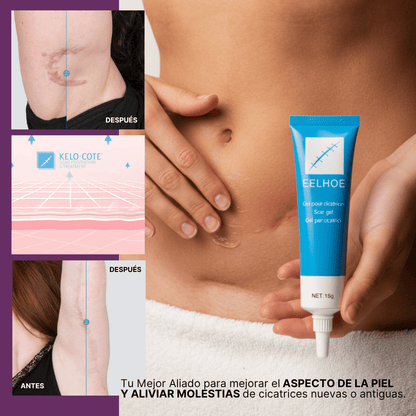 Kelo-Cote | Gel Para Cicatrices