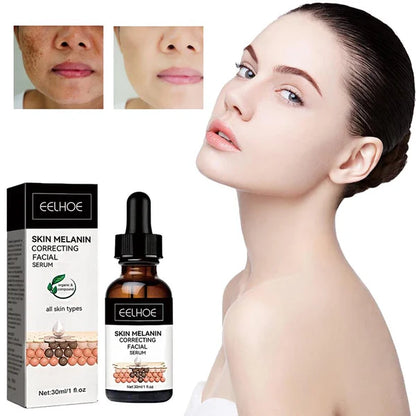 Suero Facial Corrector de Melanina