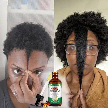 Aceite de Batana para el crecimiento del cabello 100% natural