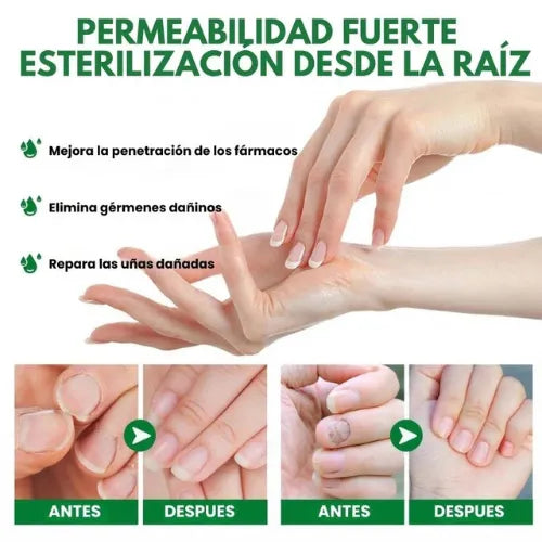 7 Days Fungus Free Nails® | Protege y elimina el hongo de tus Uñas