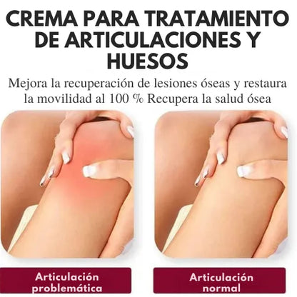 PerfectX™ Terapia Articular Y Muscular