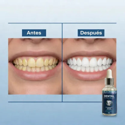 Dental Cavity | Blindaje Dental para una Sonrisa Impecable