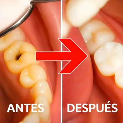 Dental Cavity | Blindaje Dental para una Sonrisa Impecable
