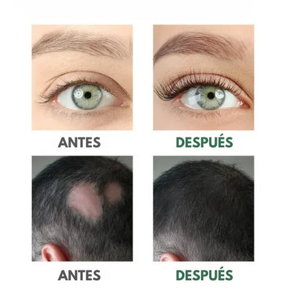 Aceite de ricino puro | Estimula el Crecimiento de Cejas, Pestañas y Cabello