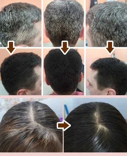 Shampoo Cubrecanas ¡Recupera la salud y color de tu cabello!